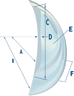 The difference and benefits of NovaKone lenses The difference and benefits of NovaKone lenses